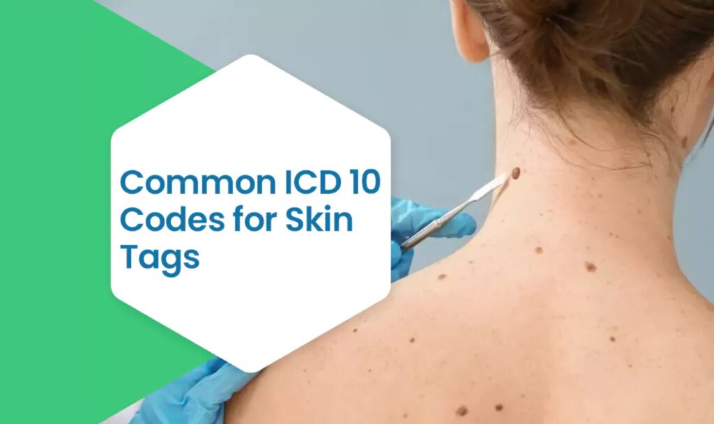 skin tag ICD 10 code