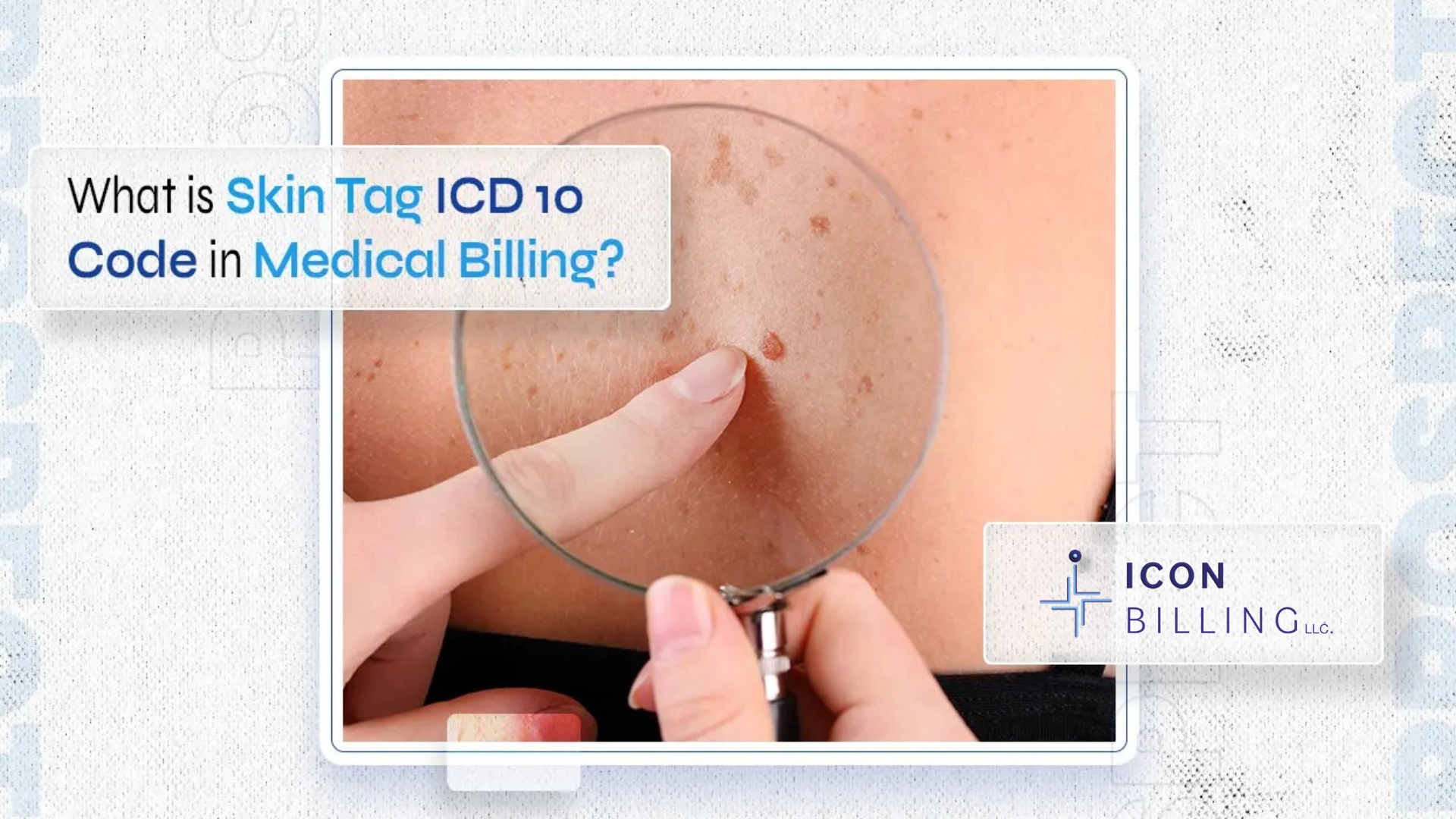 Skin Tag ICD 10 Skin Tag ICD 10