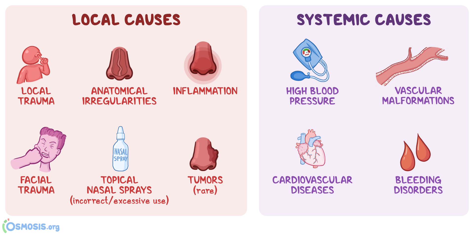 epistaxis icd 10