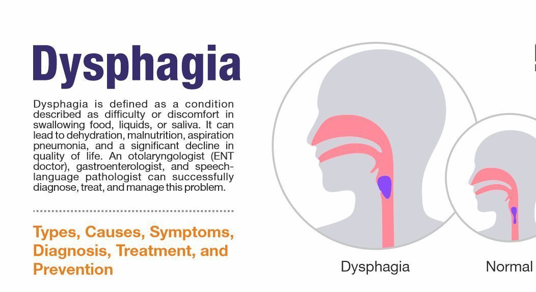 Dysphagia ICD 10