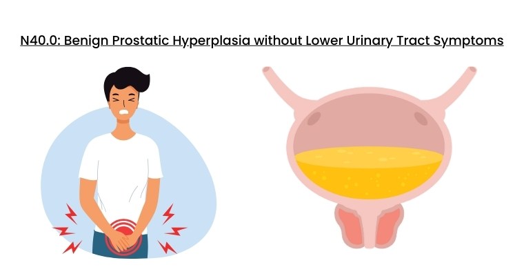 BPH ICD 10