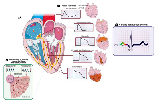 Sick Sinus Syndrome ICD 10