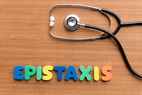 Epistaxis ICD 10