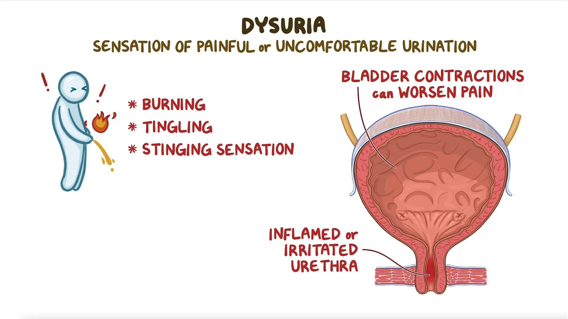 dysuria icd 10